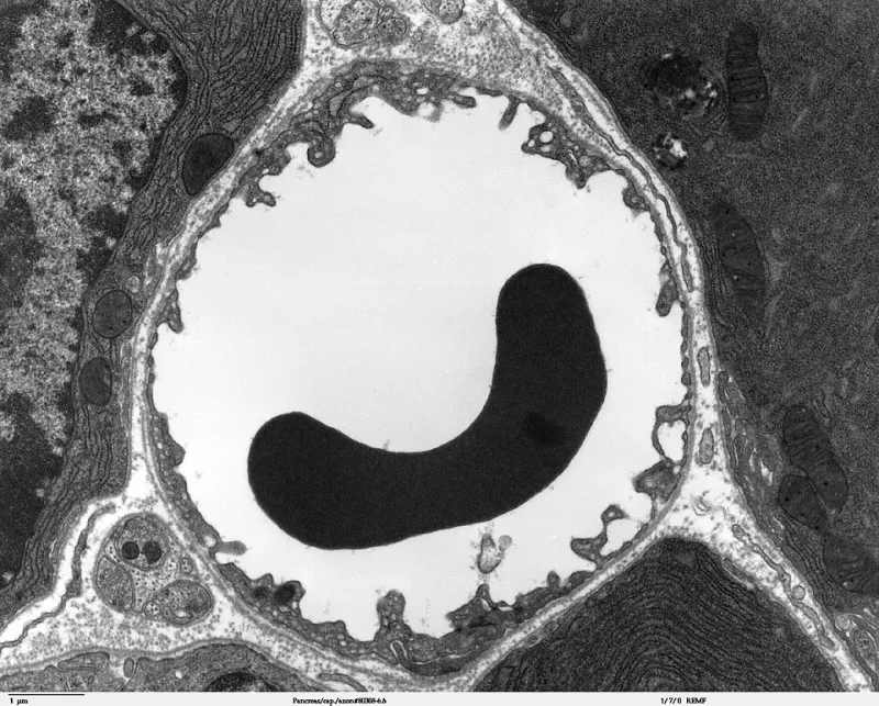 The Invisible Network Aging You From Within: What Your Capillaries Reveal About Biological Youth