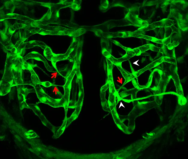 Your Brain Is Begging for Better Blood: The Circulatory Roots of Cognitive Fog