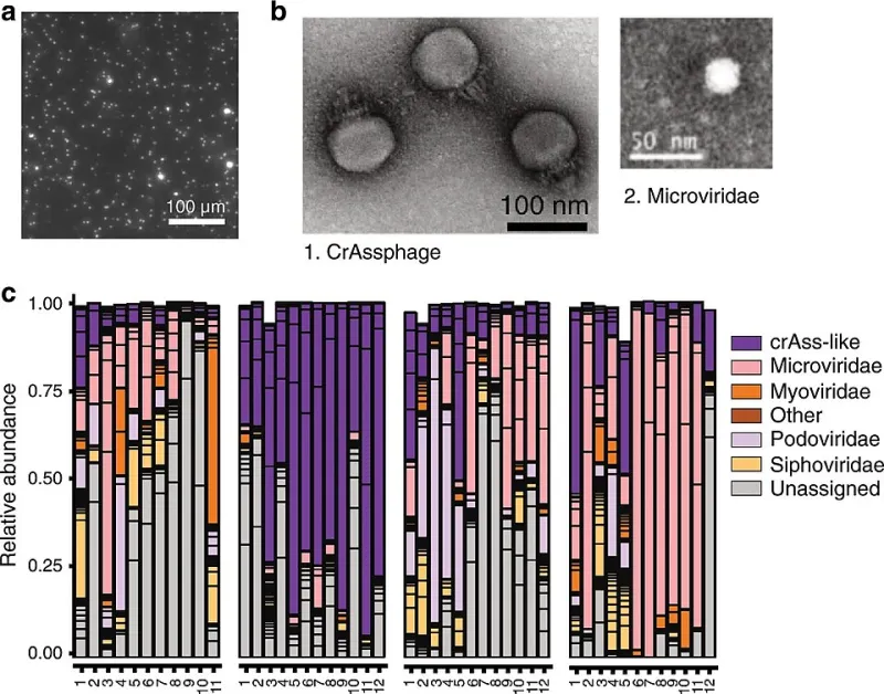 When Your Gut Wall Fails, Your Blood Pays the Price: The Cellular Science of Intestinal Permeability and Vascular Damage